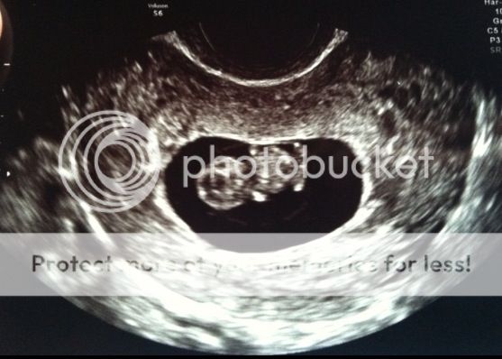 9 Week Ultrasound! Heart rate was 175! photo photo5_zps36b841a2.jpg
